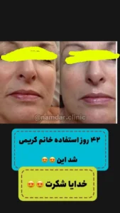 رضایت کرم کلاژن