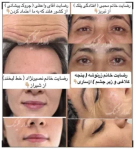 رضایت کرم کلاژن