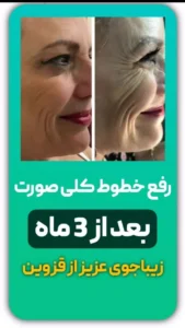رضایت کرم کلاژن
